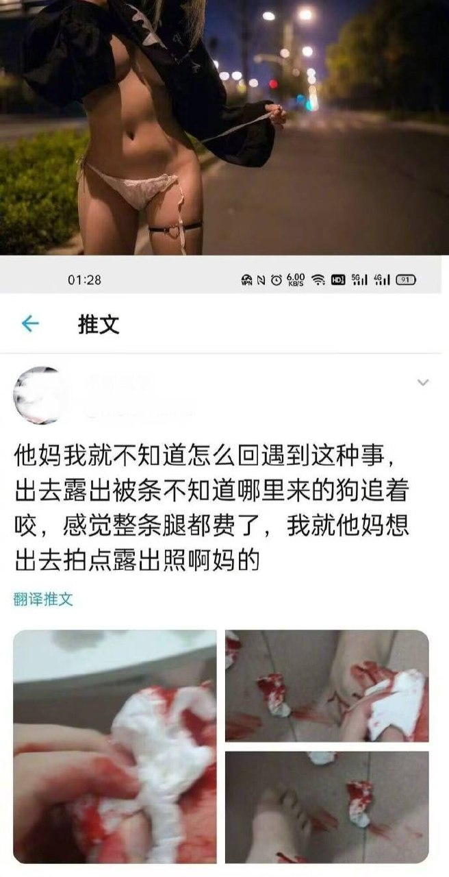 #露出 遇到狗了 窝日 ！（图片 1/1）